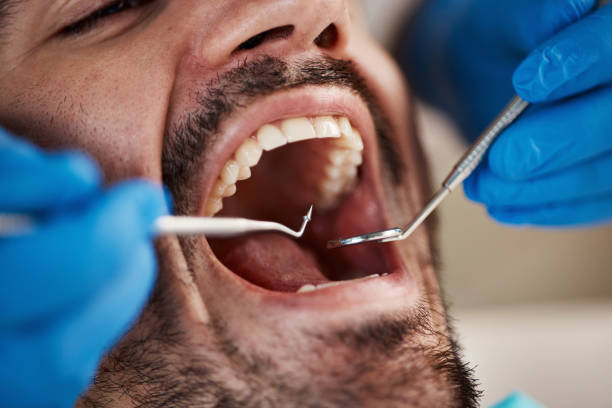 Best Emergency Dental Services for Seniors in East Northport, NY
