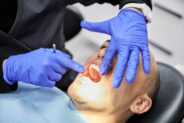 Best Emergency Dentist for Knocked-Out Tooth in East Northport, NY